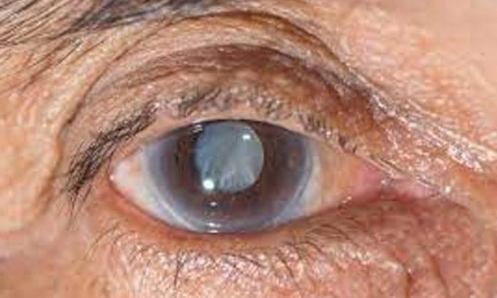 Glaucoma treatments