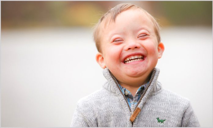 down syndrome is not disease