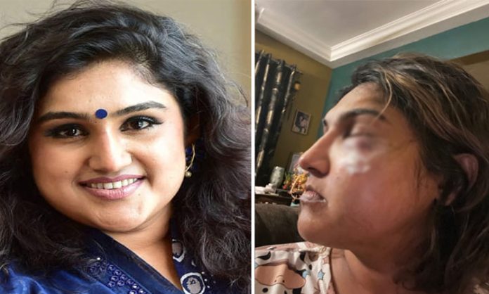 BB Tamil Vanitha Vijayakumar attacked