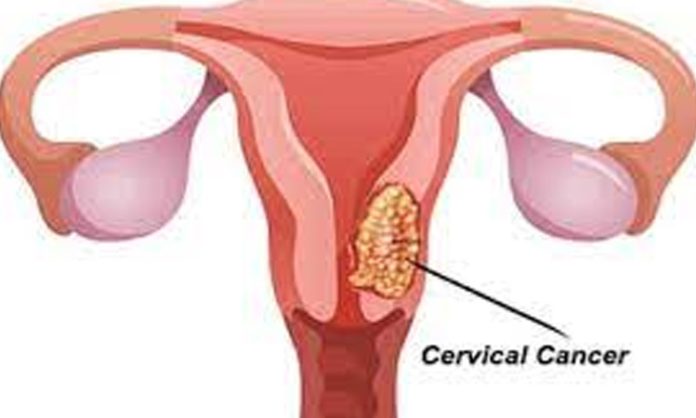 cervical cancer symptoms in telugu